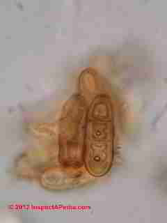 Bipolaris - Drechslera fungal spores (C) D Friedman